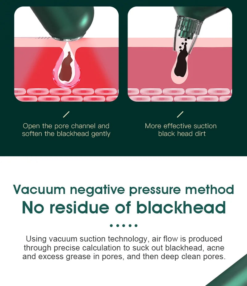Blackhead Remover Pore Vacuum with Hot Compress Electric Acne and Pimple Extractor with LCD Display 6 Suction Heads Base Stand Face Cleaner Tool for Women and Men