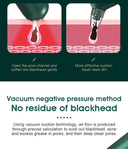 Blackhead Remover Pore Vacuum with Hot Compress Electric Acne and Pimple Extractor with LCD Display 6 Suction Heads Base Stand Face Cleaner Tool for Women and Men